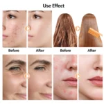 ClariGlow Pro High Frequency Facial Wand Set - Image 5