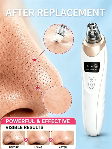 PorePure Pro Rechargeable Blackhead Vacuum & Pore Cleanser