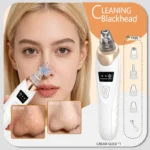 PorePure Pro Rechargeable Blackhead Vacuum & Pore Cleanser - Image 7