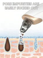 PorePure Pro Rechargeable Blackhead Vacuum & Pore Cleanser - Image 4