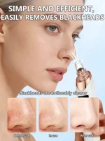 PorePure Pro Rechargeable Blackhead Vacuum & Pore Cleanser - Image 5