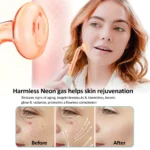 ClariGlow Pro High Frequency Facial Wand Set - Image 4