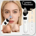 PorePure Pro Rechargeable Blackhead Vacuum & Pore Cleanser - Image 9