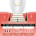 LumiSilk Pro 500K IPL Hair Reduction Device - Image 4